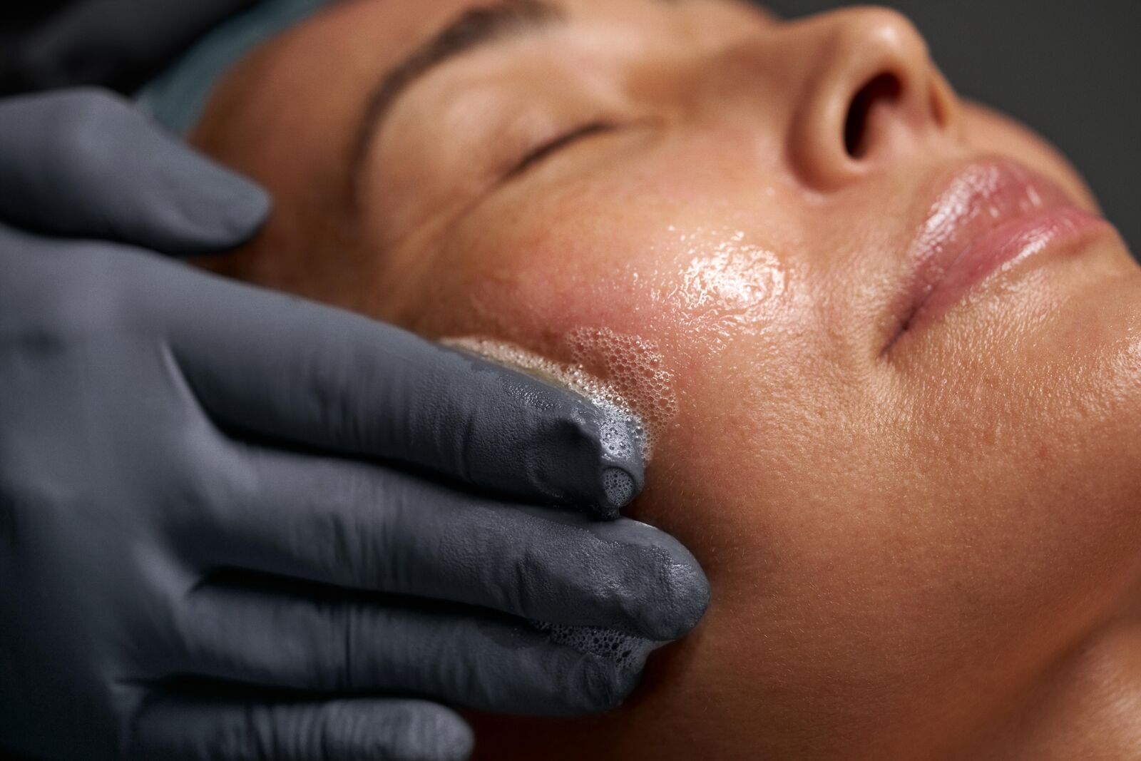 Professional chemical peel treatment being applied to a client's face