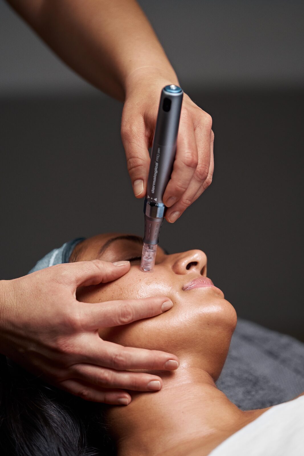 Micro-needling